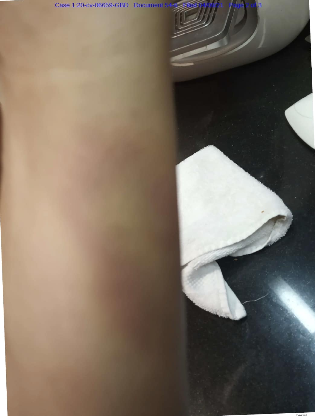 תמונה שטל לוילוז'ני הציגה כראיה לשימוש בסמים