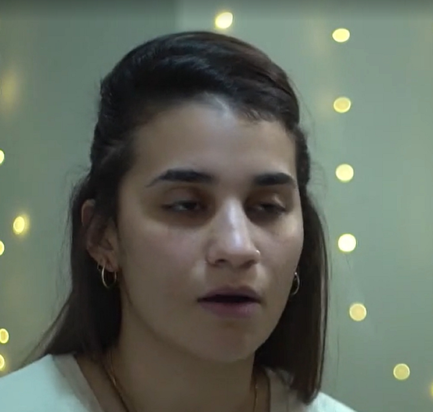 אורן קריאף טוענת שמעסה הומו אנס אותה בעיסוי רקמות