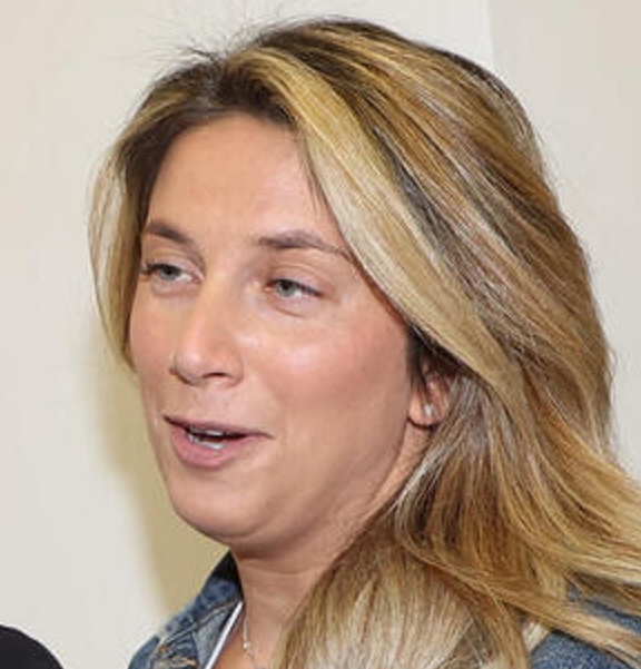 בר כץ התכערה יותר מידי חומצה נשפכה עליה